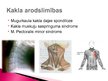 Presentations 'Mugurkaula kakla daļas spondiloze', 5.