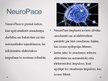 Presentations 'Mikročipu implanti smadzenēs un prāta kontrole', 6.