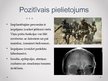 Presentations 'Mikročipu implanti smadzenēs un prāta kontrole', 7.