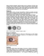 Research Papers 'Redzes funkciju īpatnības dažādu acs pataloģiju gadījumos', 4.
