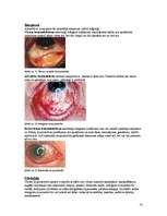 Research Papers 'Redzes funkciju īpatnības dažādu acs pataloģiju gadījumos', 14.