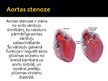 Presentations 'Aortas stenoze', 2.