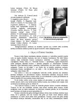 Term Papers 'Ceļa locītavas rentgenogrāfija traumu gadījumā', 12.