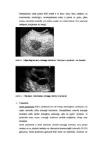 Research Papers 'Endoskopiskā ultrasonogrāfija', 6.