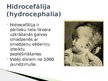 Presentations 'Hidrocefālija', 2.