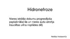 Presentations 'Hidronefroze', 1.