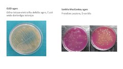 Presentations 'Escherichia coli mikrobioloģiskās diagnostikas principi', 11.