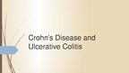 Presentations 'Crohn's Disease', 1.
