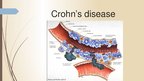 Presentations 'Crohn's Disease', 4.