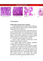 Research Papers 'Histoloģija. Endometrija hiperplastiskie procesi', 4.
