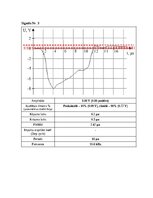 Samples 'Impulsveida signālu parametri', 5.