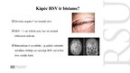 Presentations 'Kāpēc zobu higiēnistiem nekad nevajadzētu ārstēt pacientu ar aktīvu orālo herpes', 11.