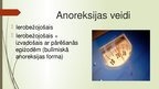 Presentations 'Anoreksija', 3.