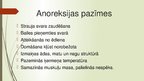 Presentations 'Anoreksija', 11.