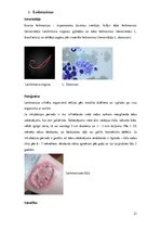 Research Papers 'Medicīniskā parazitoloģija. Helmintozes', 21.