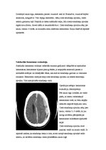 Research Papers 'Neiroķirurģisko operāciju apraksti', 5.