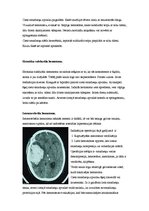 Research Papers 'Neiroķirurģisko operāciju apraksti', 6.