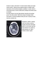 Research Papers 'Neiroķirurģisko operāciju apraksti', 23.