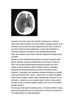Research Papers 'Neiroķirurģisko operāciju apraksti', 24.