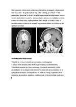 Research Papers 'Neiroķirurģisko operāciju apraksti', 25.