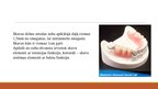 Presentations 'Izņemamās parciālās zobu protēzes ar plastmasas bāzi izgatavošanas klīniskie, la', 21.