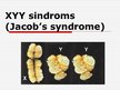 Presentations 'XYY - sindroms', 1.