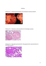 Research Papers 'Hronisks glomerulonefrīts', 13.