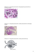 Research Papers 'Hronisks glomerulonefrīts', 14.
