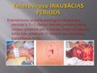 Presentations 'Meningokoku infekcija', 14.