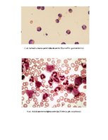 Research Papers 'Asins analīžu izmaiņas no cērmju invāzijas, kuņģa - zarnu trakta asiņošanas un c', 30.