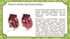 Presentations 'Kardiomiopātija Bērniem', 5.