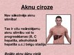 Presentations 'Aknu ciroze', 4.