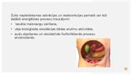 Presentations 'Aknu pamatfunkciju traucējumi: Žults veidošanās un izdales traucējumi', 13.