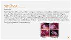Presentations 'Aknu pamatfunkciju traucējumi: Žults veidošanās un izdales traucējumi', 21.