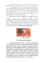Research Papers 'Izplatītākās acu slimības jauniešiem', 11.