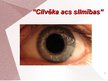 Presentations 'Cilvēka acu un redzes slimības', 1.