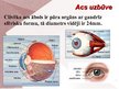 Presentations 'Cilvēka acu un redzes slimības', 2.