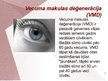 Presentations 'Cilvēka acu un redzes slimības', 5.