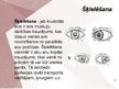 Presentations 'Cilvēka acu un redzes slimības', 17.
