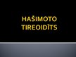 Presentations 'Hašimoto tireoidīts', 1.