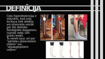 Presentations 'Ceļa hiperekstensija', 2.