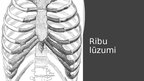 Presentations 'Iegurņa kaula lūzumi, iegurņa stabilizācijas tehnikas. Krūšu kurvja, krūšu kaula', 15.