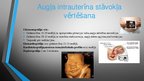 Presentations 'Cukura un gestācijas diabēts grūtniecības laikā', 6.