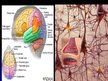 Presentations 'Cilvēka nervu sistēma un tās slimības', 26.