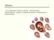 Presentations 'Nelabvēlīgo faktoru ietekme uz embrija attīstību', 3.