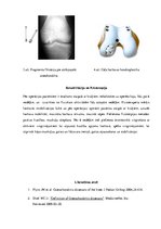 Research Papers 'Osteohondritis dissecans jeb atslāņojošais osteohondrīts', 5.