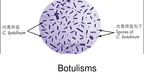 Presentations 'Ūdens piesārņojums - botulisma nūjiņa', 1.