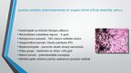 Presentations 'Jauktu putekļu pneimokoniozes', 4.