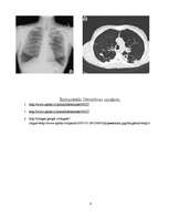 Research Papers 'Hroniski obstruktīva plaušu slimība (HOPS)', 9.