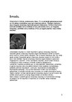 Research Papers 'Galvas smadzeņu traumas', 3.